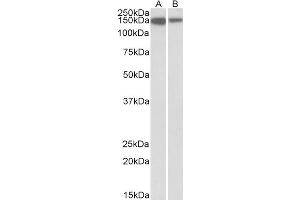 Western Blotting (WB) image for anti-MCF.2 Cell Line Derived Transforming Sequence-Like (MCF2L) antibody (ABIN5903434) (MCF2L antibody)