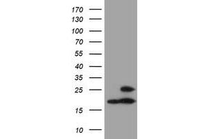 Western Blotting (WB) image for anti-Proteasome (Prosome, Macropain) Subunit, beta Type, 9 (Large Multifunctional Peptidase 2) (PSMB9) (AA 21-219) antibody (ABIN1491193) (PSMB9 antibody  (AA 21-219))