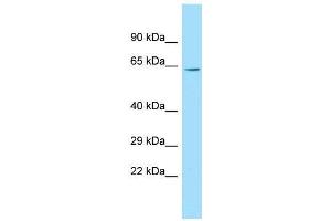 Host:  Rabbit  Target Name:  Cacnb2  Sample Type:  Rat Thymus lysates  Antibody Dilution:  1. (CACNB2 antibody  (Middle Region))