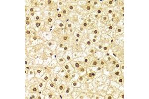 Immunohistochemistry (Paraffin-embedded Sections) (IHC (p)) image for anti-Lamin A/C (LMNA) (AA 403-572) antibody (ABIN3020785)