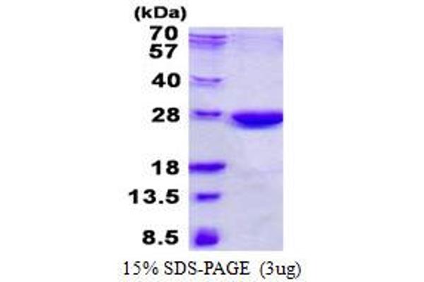 NHEJ1 Protein (His tag)