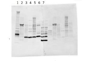 Western Blotting (WB) image for anti-Desmoplakin (DSP) antibody (ABIN1742177) (Desmoplakin antibody)