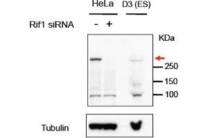 Western Blotting (WB) image for anti-RAP1 Interacting Factor Homolog (RIF1) (AA 2432-2444) antibody (ABIN1103996) (RIF1 antibody  (AA 2432-2444))