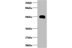 Western blot All lanes: CCL2 antibody at 2 μg/mL + EC109 whole cell lysate Secondary Goat polyclonal to rabbit IgG at 1/15000 dilution Predicted band size: 12 kDa Observed band size: 50 kDa (CCL2 antibody  (AA 24-99))