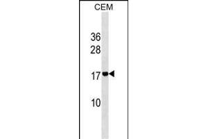 肾上腺髓质素2抗体（AA 15-42）