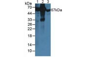 Figure. (Albumin antibody)