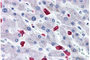 Human Liver (formalin-fixed, paraffin-embedded) stained with CD163 antibody ABIN337380 at 20 ug/ml followed by biotinylated goat anti-rabbit IgG secondary antibody ABIN481713, alkaline phosphatase-streptavidin and chromogen. (CD163 antibody  (N-Term))