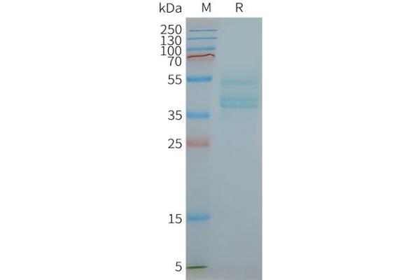 CCR6 Protein