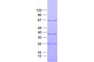 Validation with Western Blot (GLS2 Protein (His tag))