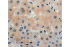 IHC-P analysis of liver tissue, with DAB staining. (CMTM8 antibody  (AA 1-173))