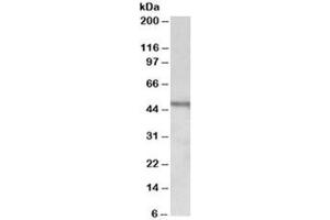 Western blot testing of Daudi lysate with CHIT1 antibody at 1ug/ml. (Chitotriosidase 1 antibody)