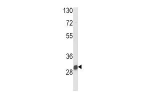 Western blot analysis of NAT2 Antibody (C-term) (ABIN652275 and ABIN2841158) in mouse kidney tissue lysates (35 μg/lane). (NAT2 antibody  (C-Term))