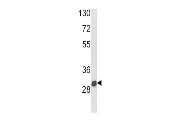 NAT2 antibody  (C-Term)