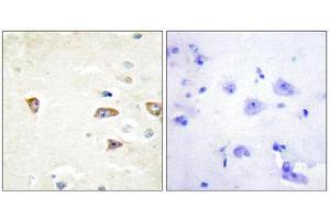 Immunohistochemistry (IHC) image for anti-CDC42 Binding Protein Kinase beta (DMPK-Like) (CDC42BPB) (C-Term) antibody (ABIN1850128) (CDC42BPB antibody  (C-Term))