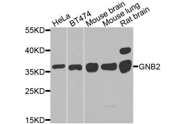 GNB2 抗体  (AA 1-340)