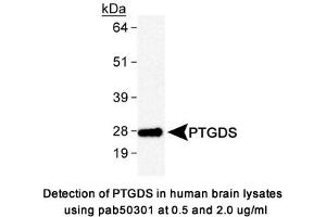 Image no. 1 for anti-Prostaglandin D2 Synthase (PTGDS) antibody (ABIN363610) (PTGDS antibody)