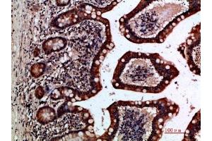 Immunohistochemical analysis of paraffin-embedded human-small-intestine, antibody was diluted at 1:200. (GREM2 antibody  (AA 71-120))