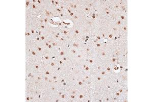 Immunohistochemistry of paraffin-embedded rat brain using RBM3 antibody  at dilution of 1:100 (40x lens). (RBM3 antibody  (AA 1-157))