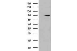 HEK293T cells were transfected with the pCMV6-ENTRY control (Left lane) or pCMV6-ENTRY HDAC10 (Right lane) cDNA for 48 hrs and lysed. (HDAC10 antibody)