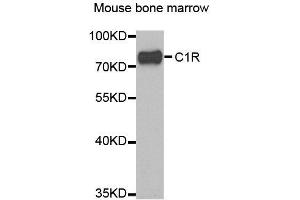 Western blot analysis of extracts of mouse bone marrow, using C1R antibody. (C1R antibody)