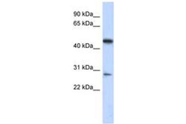 LACC1 antibody  (AA 179-228)