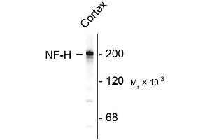 Western blots of rat cortex lysate showing specific immunolableing of the ~ 200k NF-H protein. (NEFH antibody)
