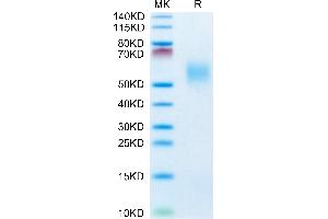 Cynomolgus FGFR2 beta (IIIb) on Tris-Bis PAGE under reduced condition. (FGFR2 alpha (AA 154-368) protein (His tag))