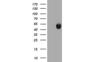 Image no. 1 for anti-Carbonic Anhydrase 12 (CA12) antibody (ABIN1497067) (CA12 antibody)