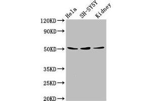 Western Blot Positive WB detected in: Hela whole cell lysate, SH-SY5Y whole cell lysate, Mouse kidney tissue All lanes: RARG antibody at 8 μg/mL Secondary Goat polyclonal to rabbit IgG at 1/50000 dilution Predicted band size: 51, 50, 43, 48 kDa Observed band size: 51 kDa (Retinoic Acid Receptor gamma antibody  (AA 13-87))