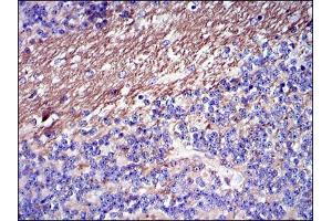 Immunohistochemistry (IHC) image for anti-Fibrinogen gamma Chain (FGG) antibody (ABIN969142)