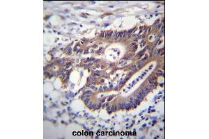 Immunohistochemistry (Paraffin-embedded Sections) (IHC (p)) image for anti-Keratin 12 (KRT12) (AA 442-471), (C-Term) antibody (ABIN656663)