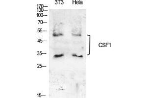 Western Blot analysis of NIH-3T3, hela cells using M-CSF Polyclonal Antibody. (M-CSF/CSF1 antibody  (C-Term))