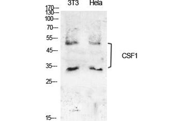 M-CSF/CSF1 antibody  (C-Term)