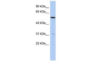 TMEM161B antibody used at 1 ug/ml to detect target protein. (TMEM161B antibody  (N-Term))