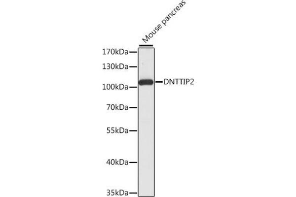 DNTTIP2 antibody  (AA 1-300)