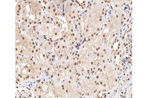 ABIN6266470 at 1/200 staining human kidney tissue sections by IHC-P. (MAPKAP Kinase 5 antibody  (pThr182))