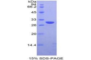 SDS-PAGE (SDS) image for Moesin (MSN) ELISA Kit (ABIN6720496)