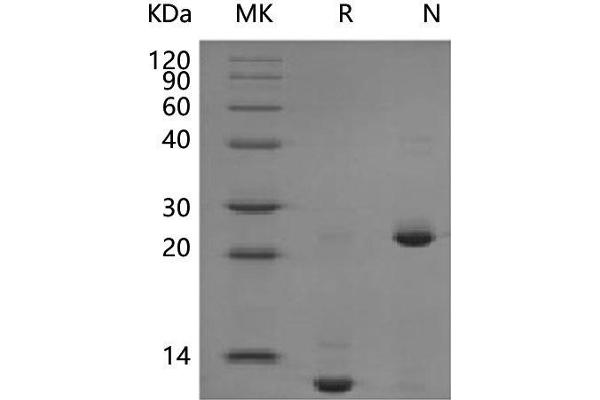 TGFB2 Protein