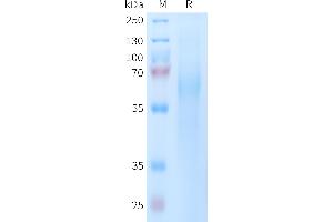 Human Protein, His Tag on SDS-PAGE under reducing condition. (TIMD4 Protein (AA 25-314) (His tag))