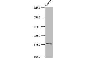 Western Blot Positive WB detected in: Mouse heart tissue All lanes: UBE2L3 antibody at 3 μg/mL Secondary Goat polyclonal to rabbit IgG at 1/50000 dilution Predicted band size: 18, 15, 25 kDa Observed band size: 18 kDa (UBE2L3 antibody  (AA 1-154))