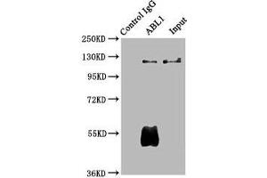 Immunoprecipitating ABL1 in Hela whole cell lysate Lane 1: Rabbit control IgG (1 μg) instead of ABIN7174001 in Hela whole cell lysate. (ABL1 antibody  (AA 4-194))