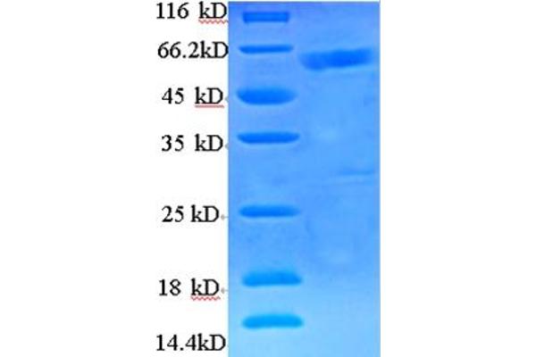 BRCC3 Protein (AA 2-316) (His-SUMO Tag)