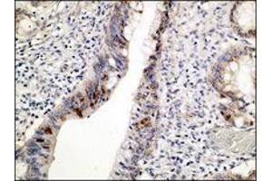 Image no. 1 for anti-Tumor Protein P53 (TP53) (N-Term) antibody (ABIN1494423) (p53 antibody  (N-Term))