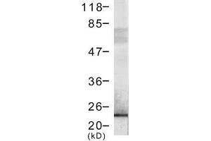 Image no. 1 for anti-DYKDDDDK Tag antibody (ABIN274245) (DYKDDDDK Tag antibody)