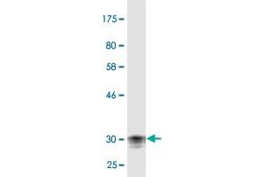 Western Blot detection against Immunogen (31. (Corneodesmosin antibody  (AA 306-355))