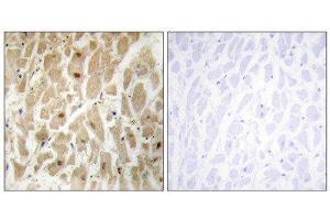 Immunohistochemistry (IHC) image for anti-Forkhead Box D3 (FOXD3) (Internal Region) antibody (ABIN1850070) (FOXD3 antibody  (Internal Region))