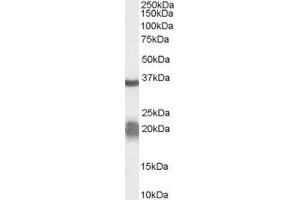 Western Blotting (WB) image for anti-Family with Sequence Similarity 132, Member A (FAM132A) (N-Term) antibody (ABIN2791522) (FAM132A antibody  (N-Term))