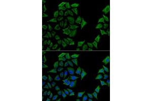 Immunofluorescence analysis of U2OS cells using TCN1 antibody (ABIN5973815). (TCN1 antibody)