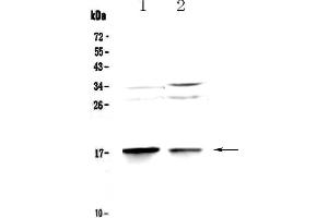 Western blot analysis of MAP1LC3A using anti-MAP1LC3A antibody . (MAP1LC3A antibody  (AA 1-120))