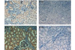 Immunohistochemistry (IHC) image for anti-Fibronectin antibody (Biotin) (ABIN5596762)